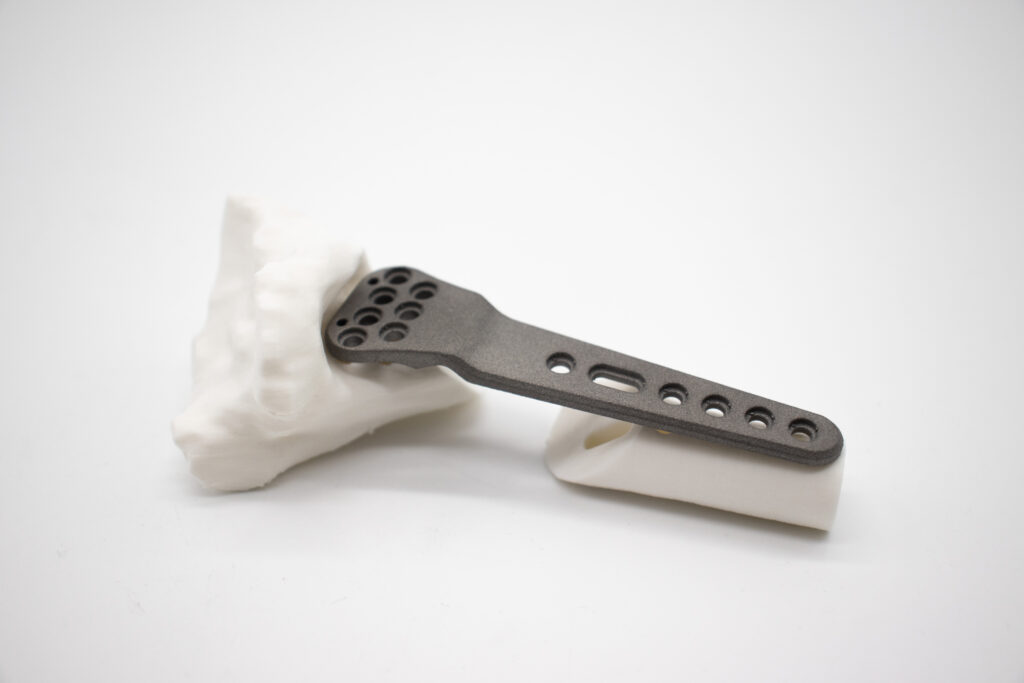 distal radius plate 1