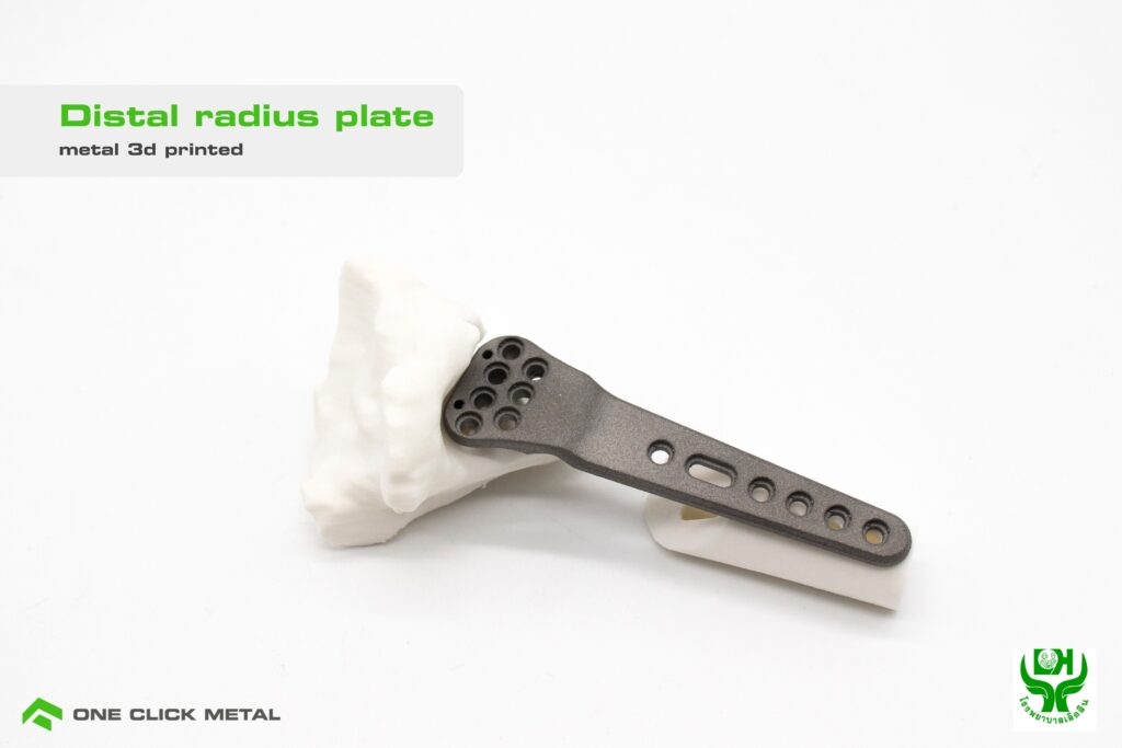 How Metal 3D Printing Is Revolutionizing Medical Implants 16